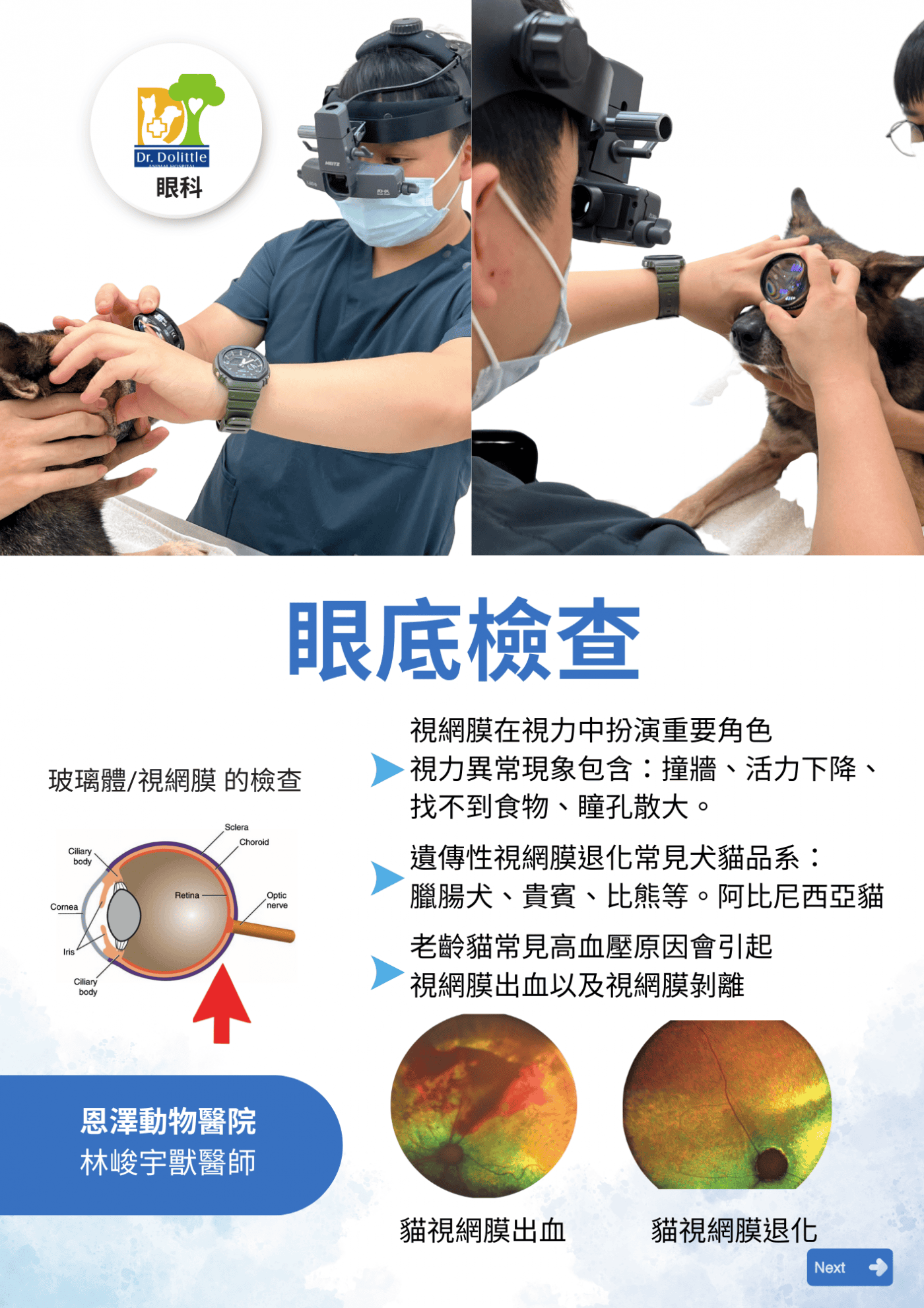 眼底檢查（玻璃體/視網膜的檢查）